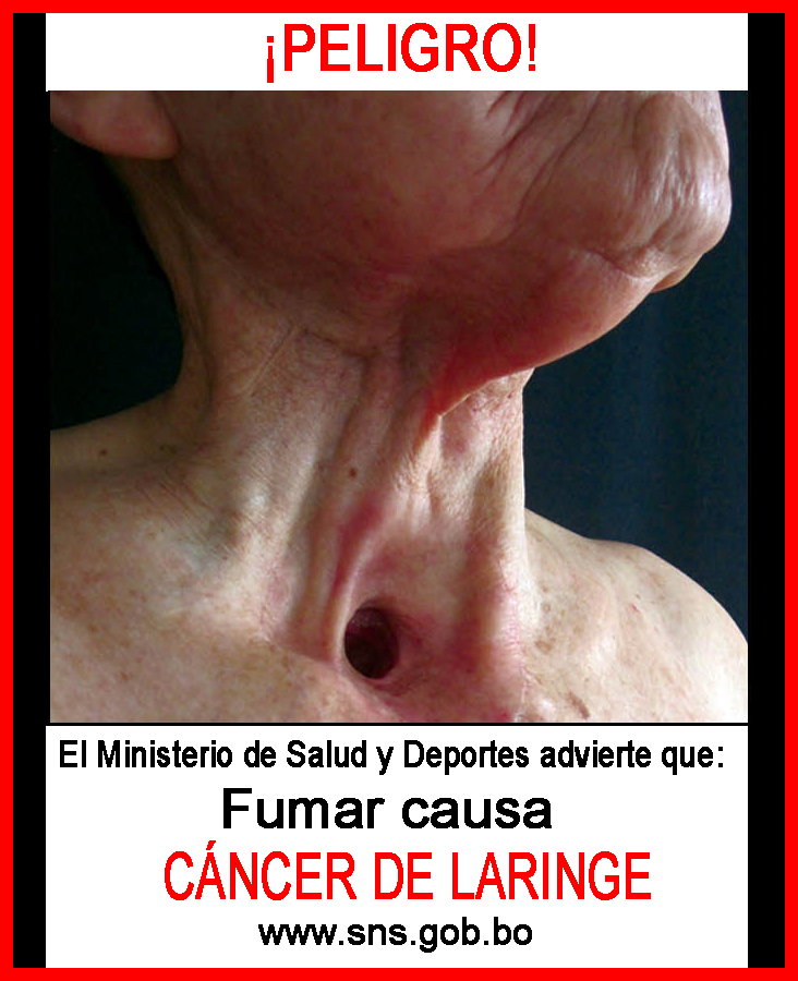 Bolivia 2011 Health Effects other - lived experience, throat cancer, gross